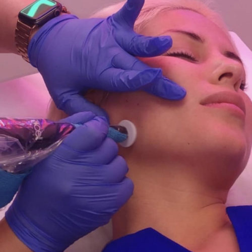 Procell treatment