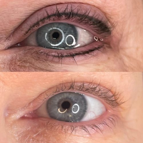 Permanent eyeliner